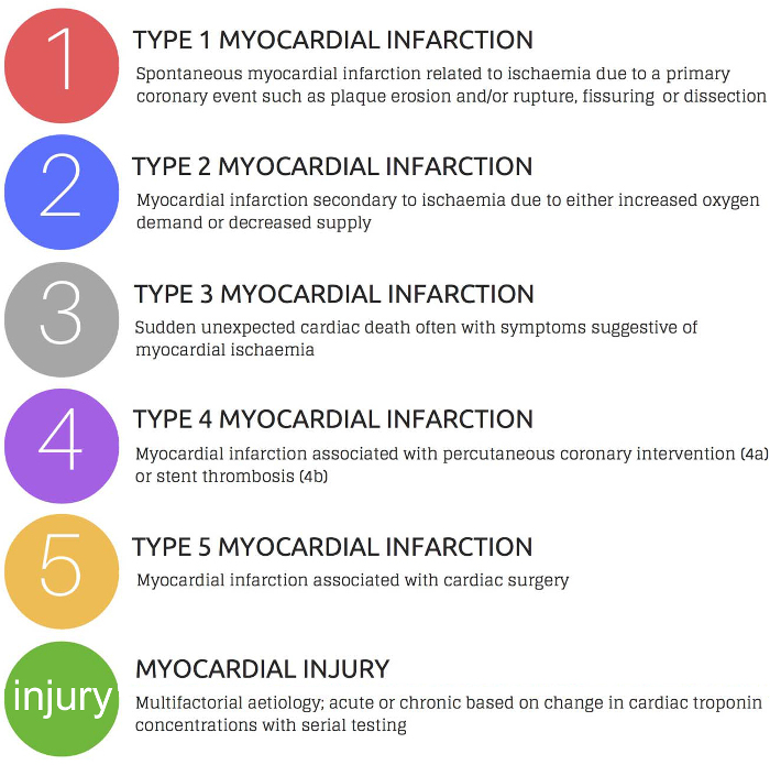 Myocardial infarction classification